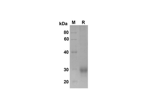 Recombinant Human FcÎ³ RIIB/CD32b Protein (His Tag) (RPES8357)