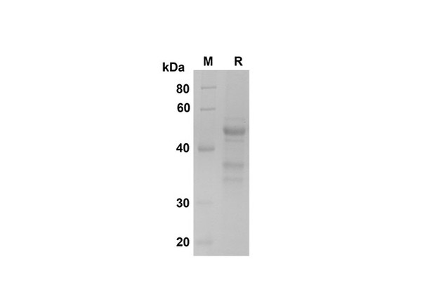 Recombinant Human IL-23 Protein (Fc Tag) (RPES8359)