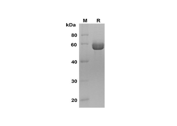 Recombinant Human AMY1A Protein (His Tag) (RPES8390)