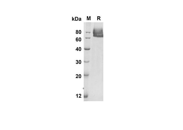 Recombinant Mouse Sele Protein (His Tag) (RPES8395)