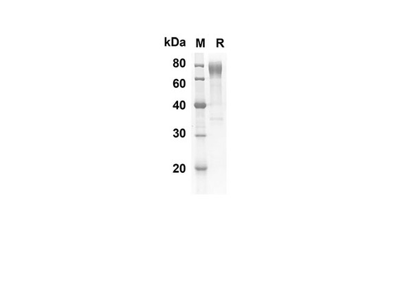 Recombinant Mouse CD30 Protein (Fc Tag) (RPES8414)