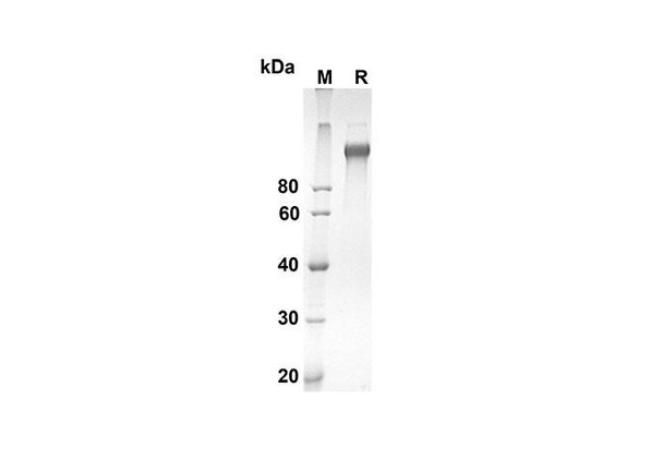 Recombinant Mouse CD163 Protein (Fc Tag) (RPES8419)