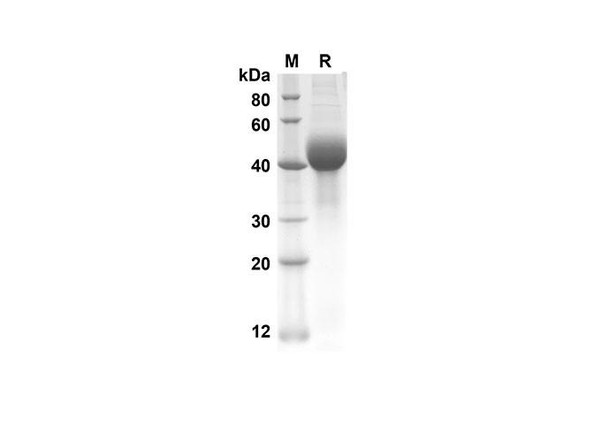 Recombinant Mouse SP-D Protein (His Tag) (RPES8442)
