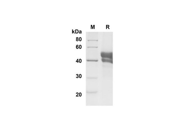 Recombinant Mouse CD27 Ligand/TNFSF7 Protein (Fc Tag) (RPES8470)