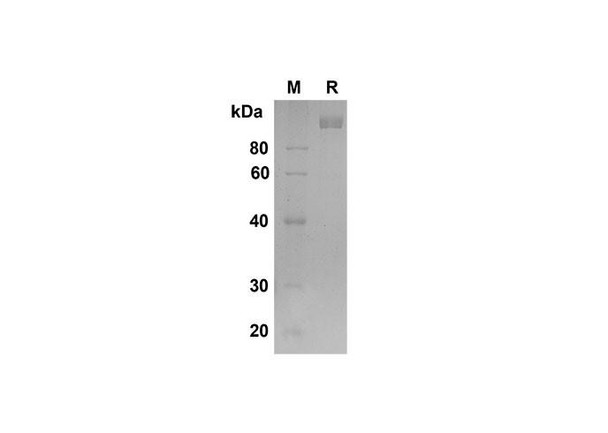 Recombinant Mouse DPPIV/CD26 Protein (Fc Tag) (RPES8475)