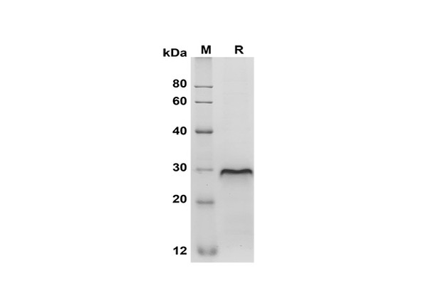 Recombinant Mouse CD40/TNFRSF5 Protein (His Tag) (RPES8497)