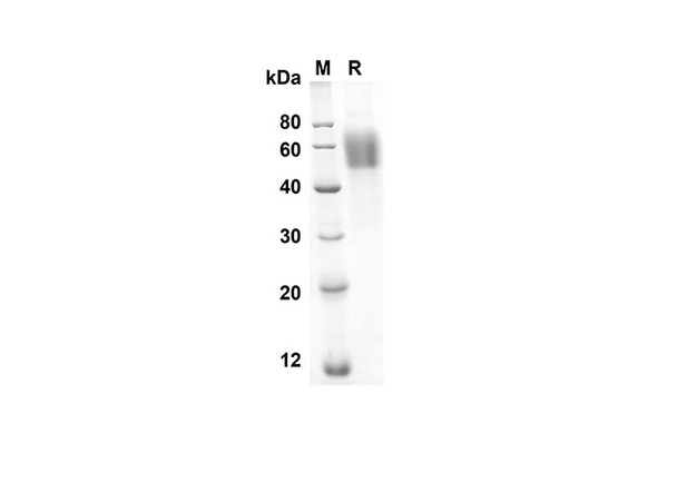 Recombinant Rat Il1R1/Il1RA Protein (His Tag) (RPES8520)