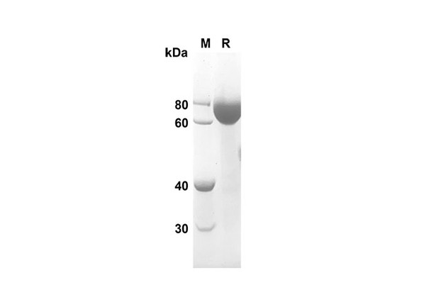 Recombinant Rat sCD14 Protein (Fc Tag) (RPES8522)