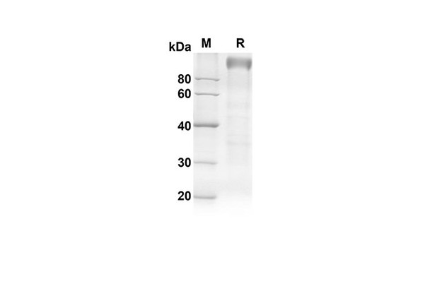 Recombinant Rat TLR4 Protein (Fc Tag) (RPES8529)
