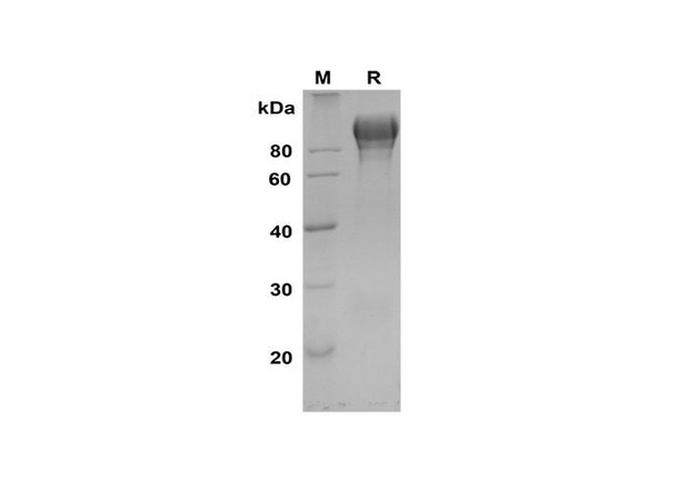 Recombinant Rat ACE2 Protein (His Tag) (RPES8543)