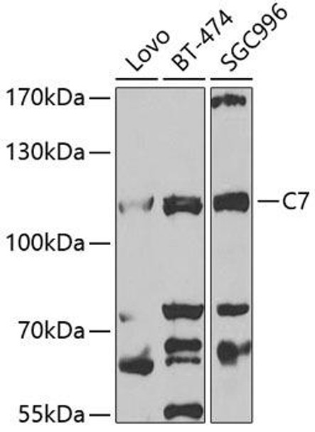 Anti-C7 Antibody (CAB5394)