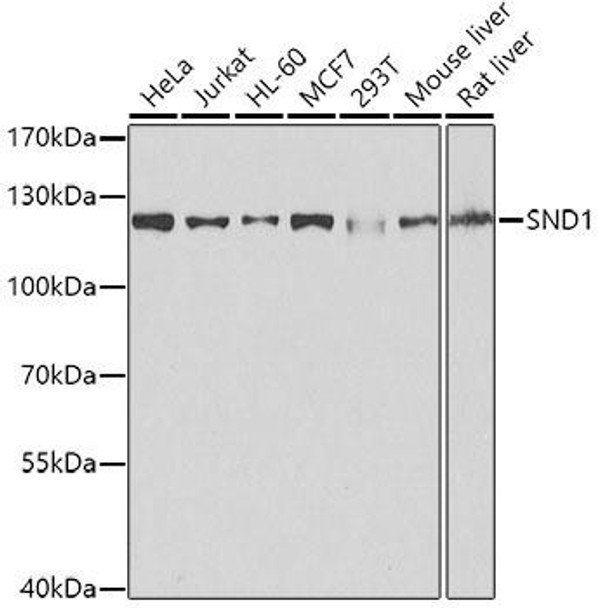 Anti-SND1 Antibody (CAB5874)[KO Validated]