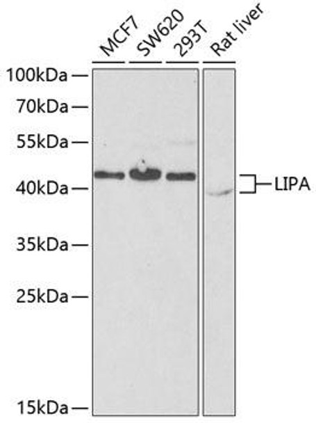 Anti-LIPA Antibody (CAB6385)