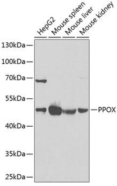 Anti-PPOX Antibody (CAB6397)