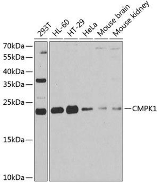 Anti-CMPK1 Antibody (CAB6561)
