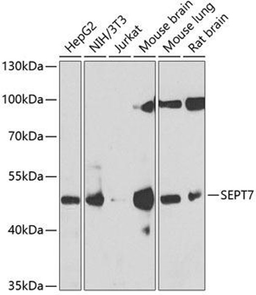 Anti-SEPT7 Antibody (CAB6883)