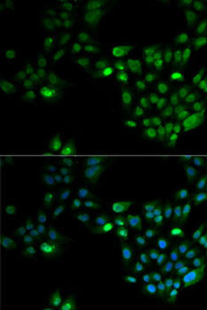 Anti-HOXA1 Antibody (CAB6924)