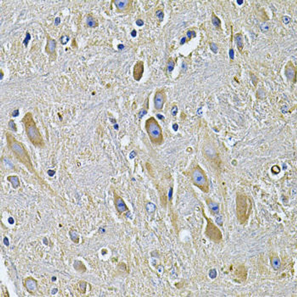 Anti-PLCG1 Antibody (CAB7711)