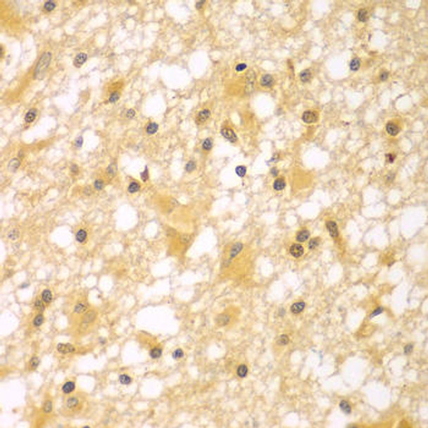 Anti-PAK6 Antibody (CAB7821)