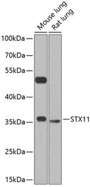 Anti-Syntaxin-11 Antibody (CAB8169)