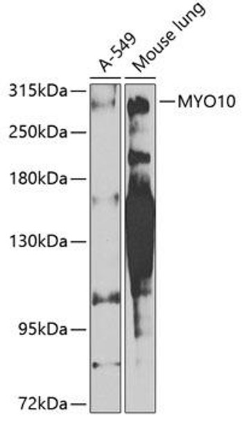 Anti-MYO10 Antibody (CAB8439)