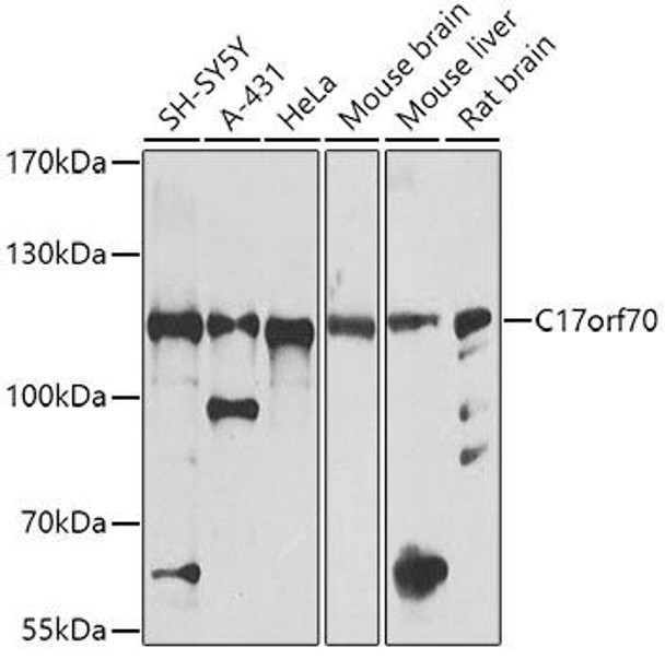 Anti-C17orf70 Antibody (CAB8591)