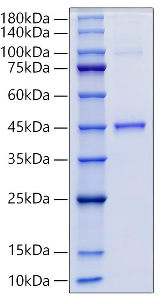 Recombinant Human GDF15 Protein (RPCB0036)