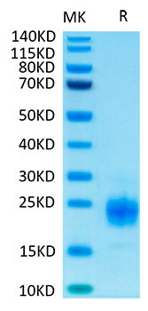 Biotinylated Recombinant Human TIGIT Protein (RPCB0041)