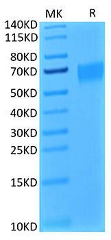 Biotinylated Recombinant Human IL-17RA/CD217 Protein (RPCB0057)