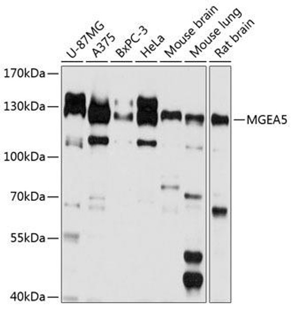 Anti-Protein O-GlcNAcase Antibody (CAB9033)