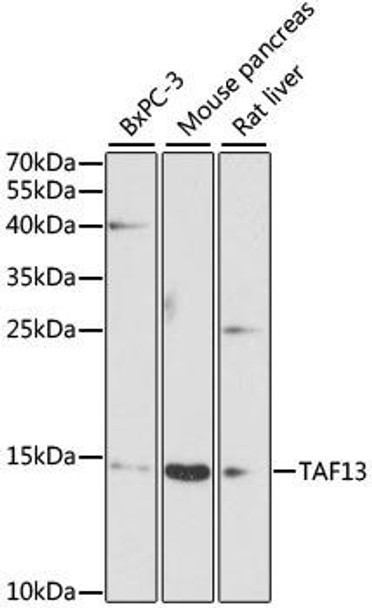 Anti-TAF13 Antibody (CAB9637)