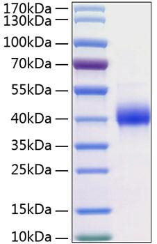 Recombinant Human Kallikrein-11/KLK11 Protein (RPCB0196)