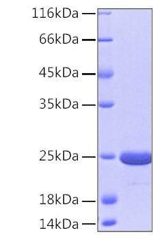 Recombinant Human DJ-1/PARK7 Protein (RPCB0200)