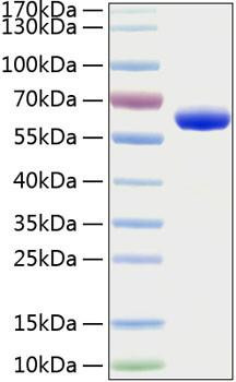Recombinant Human Erythropoietin R/EPO-R Protein (RPCB0208)