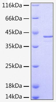 Recombinant Human Alpha-2-MRAP/LRPAP1 Protein (RPCB0214)