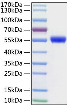 Recombinant Human uPA/PLAU Protein (RPCB0227)