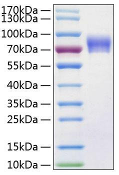 Recombinant Human Vanin-1/VNN1 Protein (RPCB0228)