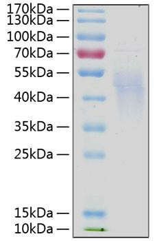 Recombinant Human IL-4R alpha/CD124 Protein (RPCB0232)