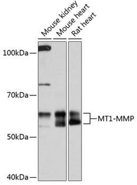 Anti-MT1-MMP Antibody (CAB0067)