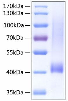 Recombinant Human Biglycan/BGN Protein (RPCB0252)