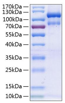 Recombinant Human EphA3 Protein (RPCB0285)