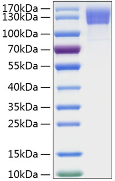 Recombinant Human OSMR/IL-31RB Protein (RPCB0300)