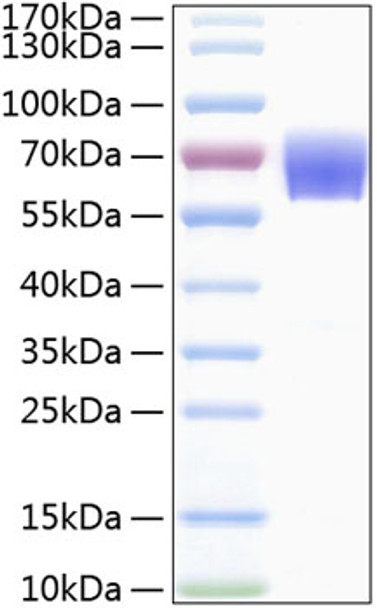 Recombinant Human TREM-1/CD354 Protein (RPCB0316)