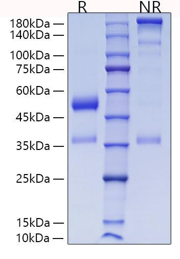 Recombinant Human Angiopoietin-like 7/ANGPTL7(27-346) Protein (RPCB0320)