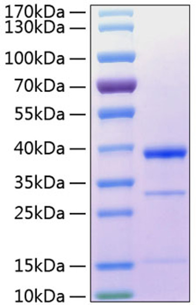 Recombinant Human Cathepsin S Protein (RPCB0329)