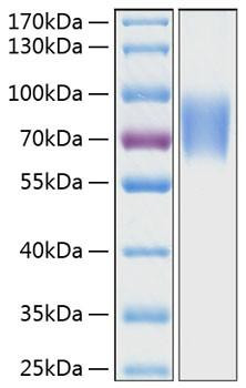 Recombinant Human LFA-3/CD58 Protein (RPCB0344)