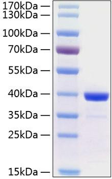 Recombinant Human Arginase 1/ARG1 Protein (RPCB0346)