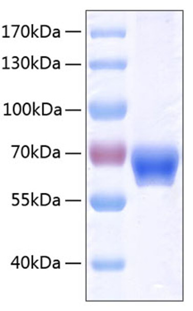Recombinant Human Ephrin-B1/EFNB1 Protein (RPCB0350)