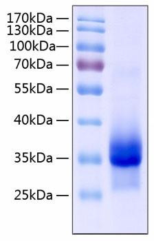 Recombinant Human IGFBP-4 Protein (RPCB0356)