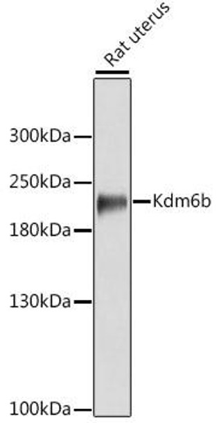 Anti-Kdm6b Antibody (CAB12764)